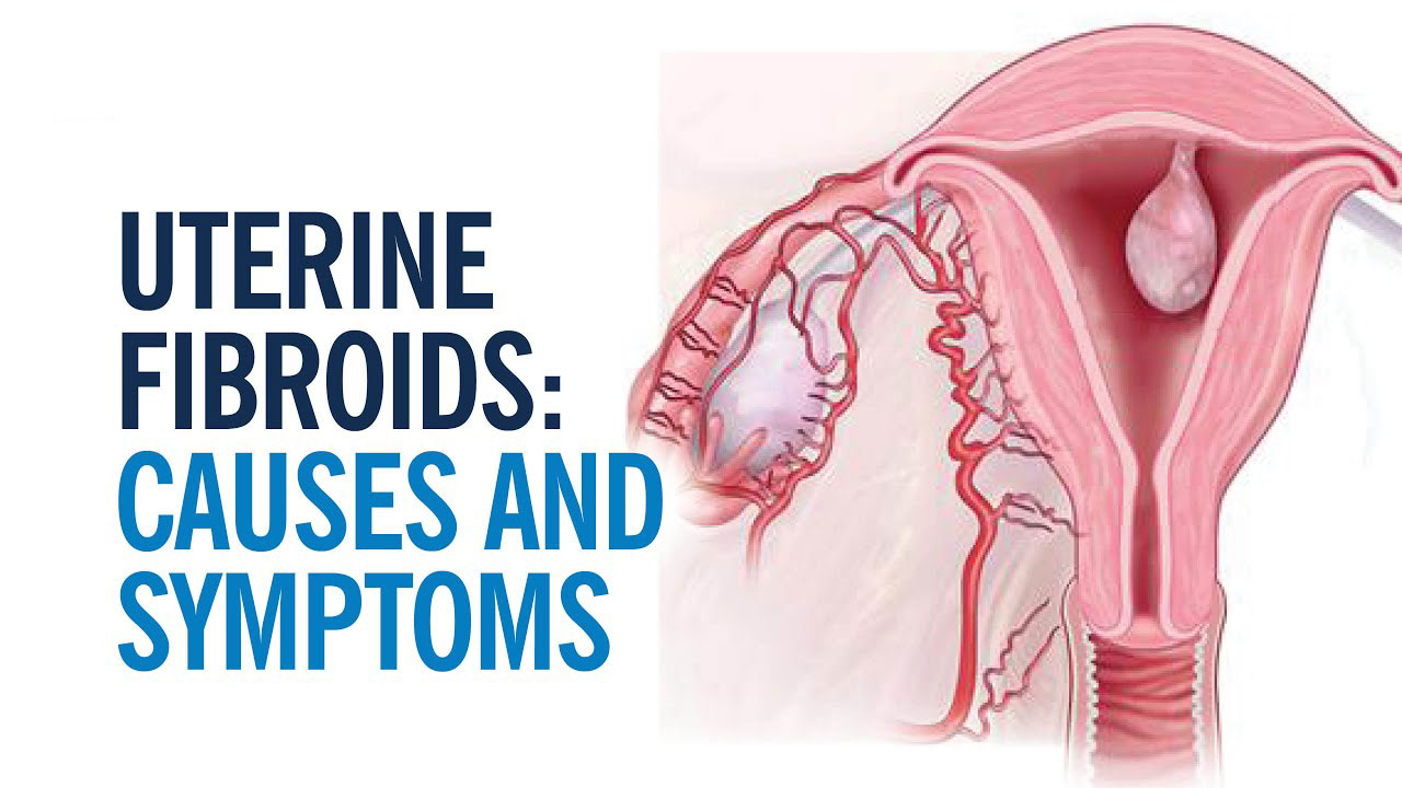 Panchakarma treatment in pune